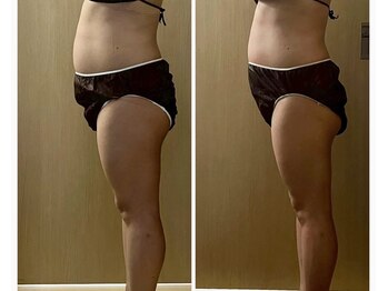 ココア(CoCoa)/活性リンパ洗浄