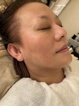 ナナプラス(nana plus)/ヘッドマッサージ