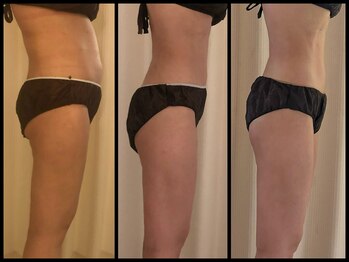 ルラシェ/10キロ減量達成!