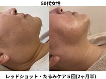 ランティル(l’until)の雰囲気（小顔・リフトアップ・たるみ・毛穴悩みなどぜひお任せください◎）