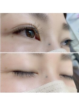 ナチュレ 武蔵浦和店(NATURE)/フラットラッシュ100本