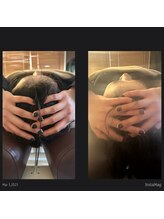 ボーンズ(BONES)/小顔矯正