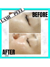 グランディールアン(GRANDIR UN)/ツヤッツヤ