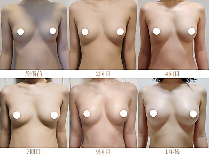 エミュボディ 青山本店(emu body)の写真