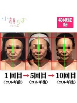 小顔整体研究所 KSラボ 新潟中山店/