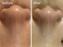 メルシア(merucia)/