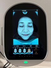 そのシミ、濃さは？数は？徹底解析し、原因を突き止める