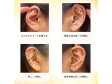 ひなた/2月限定★よもぎ蒸し×耳つぼ