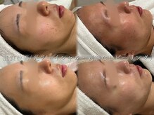 スパ ナナプラス(SPA nana+)