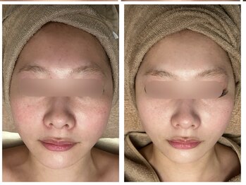 KANコルギセラピー 群馬高崎店/