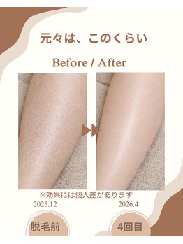 リーナ 二俣川(Ri-Na)/足がキレイだと自信につながる