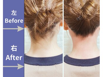 エヌ(N)/ワックス脱毛(うなじ)