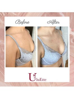 ウルエッテ(UluEtte)/削げている胸もふっくらと/育乳