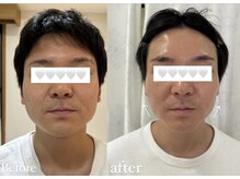 ミミルーチェ(mimiluce)/リアボーテタラソトリートメント