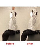 ナオル整体 福岡香椎院(NAORU整体)/30代男性施術事例【肩の痛み】
