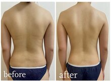 加圧ビューティーサロン スタイル エム(beauty salon style M)/20代/加圧×パワーツリー120分