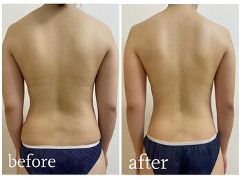 加圧ビューティーサロン スタイル エム(beauty salon style M)/20代/加圧×パワーツリー120分