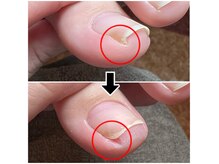 フットレスキュー(Foot ResQ)の雰囲気（ゆったり寛ぎながら施術を受けていただけます。）