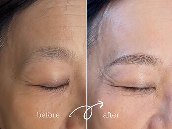 レディゴー(LADY GO)/美眉＆美肌