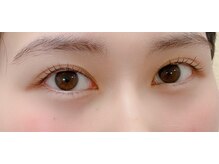 ビート(BEAT)/アディクトカール