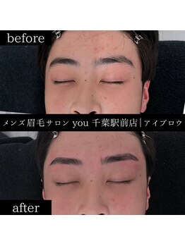ユー 千葉駅前店(you)/ビフォ-アフター写真