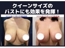 セブンシーズ 上野店(Seven Seas)/バストアップ/豊胸/東京都/上野