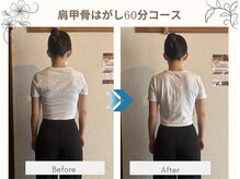 漢方アロマヒーリングサロン 浦和店(漢方AROMAヒーリングサロン)/肩甲骨はがし60分コース