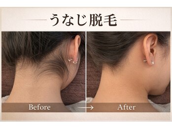 サロン ド ビー(Salon de Be)/★ うなじ脱毛等のSパーツ