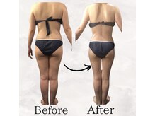 レナータ バイ アフロスクィーン(Renata by Aphros Queen)/Before&After