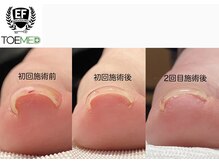 オズ ネイルアンドアイ(OZ NAIL&EYE)の雰囲気（爪のコンプレックやケアや深爪育成メニューで清潔感ある指先に！）