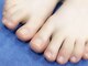 ネイル シスター(nail sister)の写真/【巻き爪にお悩みの方必見！】爪の形を整え、美しい足元へ！お悩みを解消します♪お気軽にご相談下さい☆