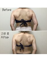 アルディート(Ardito)/肩甲骨剥がし