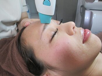 プライムローズ 銀座店(PRIME ROSE)の写真/毛穴引き締め&小顔に最強サーマクール！施術後は毛穴ツルツルお肌ピカピカ★ハリや弾力がでて目がパッチリ!