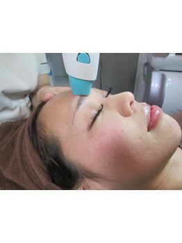 毛穴ケアをしたい