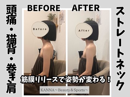 カンナ(KANNA)の写真