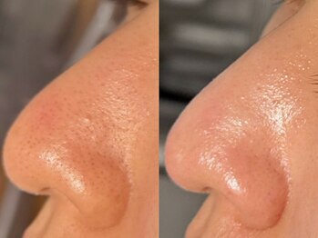 ルーナジェーナ(Luna llena)/