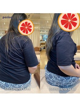 グレフル鍼灸接骨院 整体院 心斎橋/整体/肩こり/マッサージ/腰痛