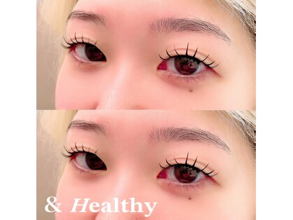 グラース(grace)の写真