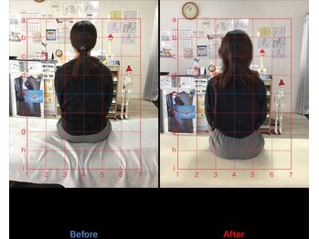 ストレチックス 近江八幡店/姿勢改善ビフォーアフター1回