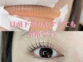 エースラッシュエヌ(A/N)/目頭下がりやすくても問題なし!