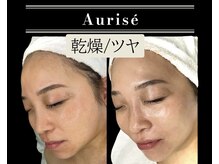 オーリス(Aurise)/