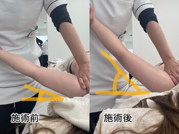 ミルタンドレス(Mille Tendresses)/筋膜リリース