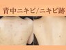 《背中ニキビケア》毛穴洗浄+背中角質除去+ビタミンCイオン導入+90分￥4400