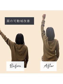 ソロウノ 平和島本院/肩関節調整