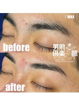男前倶楽部/脱毛/メンズ脱毛/メンズ専門店