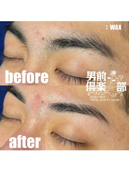 男前倶楽部/脱毛/メンズ脱毛/メンズ専門店