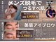 トレースの写真