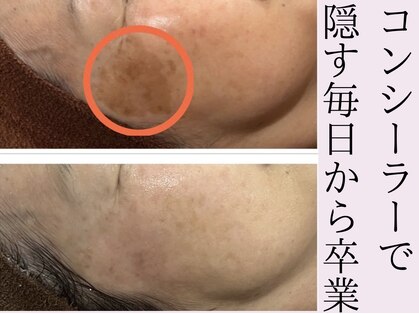 おうちサロン シュシュルームの写真