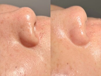 ルーナジェーナ(Luna llena)/池袋 エステ ルーナジェーナ