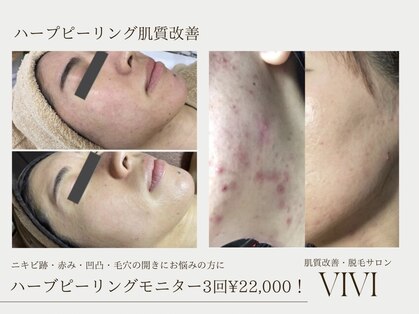 ヴィヴィ(ViVi)の写真